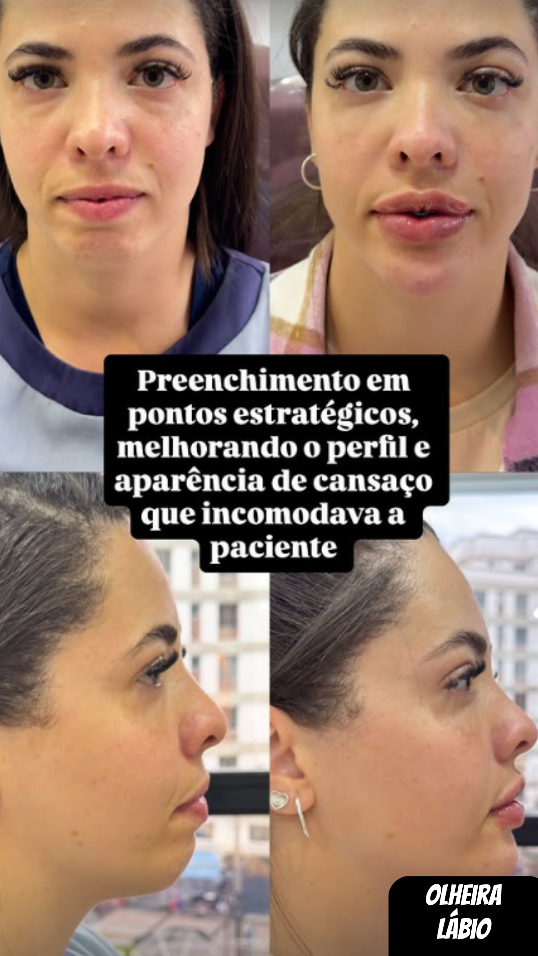 Harmonização Facial — AR Odontologia